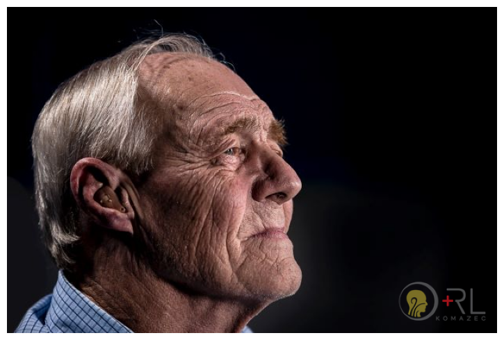 Veza izmešu nagluvosti i demencije